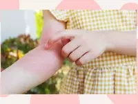 Understanding and Managing Common Skin Rashes in Toddlers