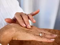 Reversing the Clock: A Dermatologist's Guide to Youthful Hands with Retinol