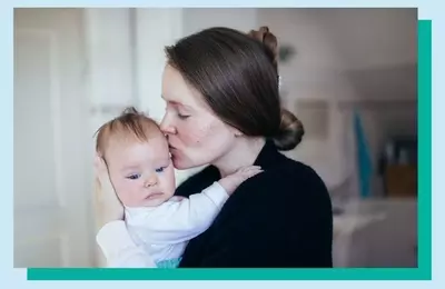Navigating the Similarities and Differences Between Postpartum and Perimenopausal Symptoms