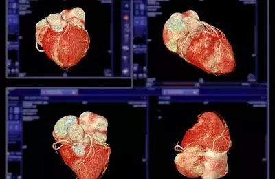 BioAge Labs: Advancing with BGE-102 in Cardiometabolic Therapies