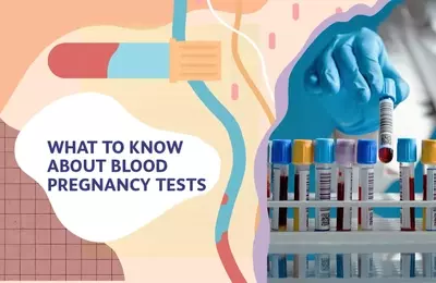 Understanding the Accuracy and Nuances of Blood Pregnancy Tests