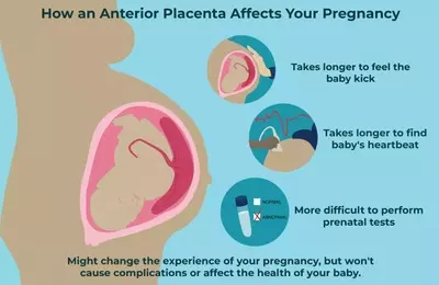 Understanding Anterior Placenta During Pregnancy