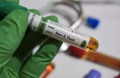 Greenwich LifeSciences: A Promising Immunotherapy for HER2-Positive Breast Cancer