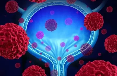 ImmunityBio: ANKTIVA's Commercial Momentum Supports A Buy