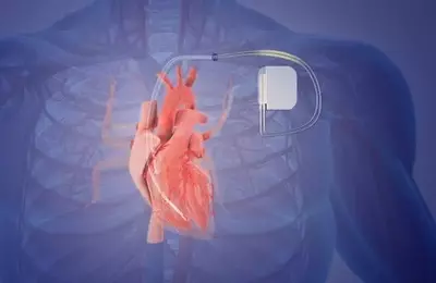 Orchestra BioMed: A Promising Horizon in Medical Device Innovation