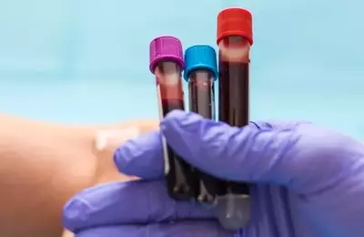 Guardant Health: High Growth, High Valuation, Uncertain Future