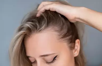 Veradermics: Pioneer in Pattern Hair Loss Treatment with Promising Oral Minoxidil