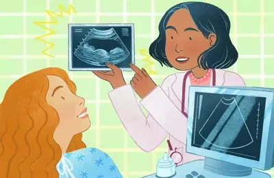 Understanding Biparietal Diameter (BPD) in Fetal Ultrasounds