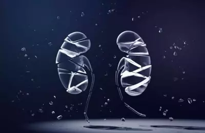 ProKidney's Rilparencel: A High-Stakes Bet on an Unproven Therapy