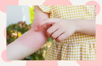 Understanding and Managing Common Skin Rashes in Toddlers