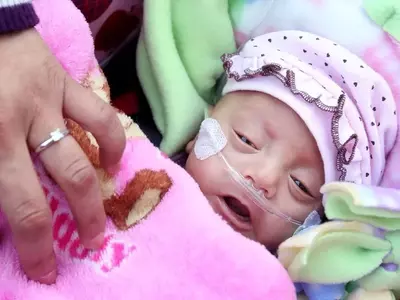 The Amazing Resilience of Premature Babies: Stories of Survival and Hope