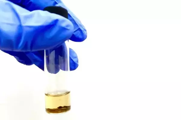 ADC Therapeutics: Downgraded to 'Sell' Amid ZYNLONTA Trial Setbacks